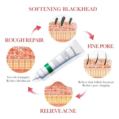 BIOAQUA Salicylic Acid Face Cream Acne Creams Mark Repair Firming Moisturizing Blackhead Remover skincare Facial Cream